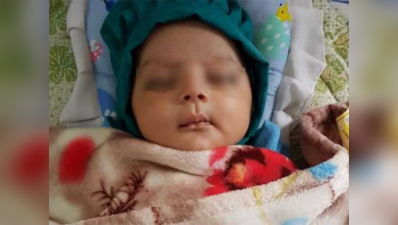 अहमदाबादः 7 दांतों के साथ जन्मा बच्चा, सर्जरी से निकाला गया
