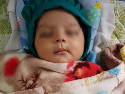 अहमदाबादः 7 दांतों के साथ जन्मा बच्चा, सर्जरी से निकाला गया
