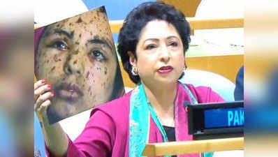 UN में गलत फोटो का इस्तेमाल? सवालों से बचने के लिए भारत पर आरोप मढ़ रहा पाक