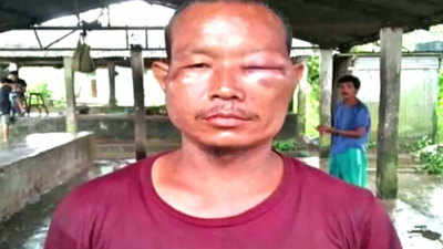 Meghalaya MLA allegedly assaults a man 