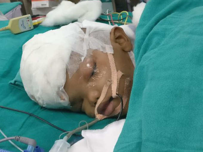 अस्पताल में ऑपरेशन के बाद दूसरे बच्चे की तस्वीर