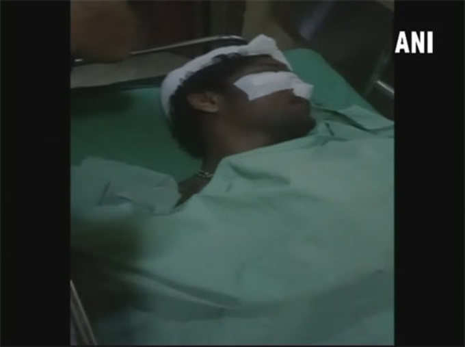 केरळः कन्नूरमध्ये ४ आरएसएस कार्यकर्त्यांवर हल्ला. हॉस्पिटलमध्ये उपचार सुरू.