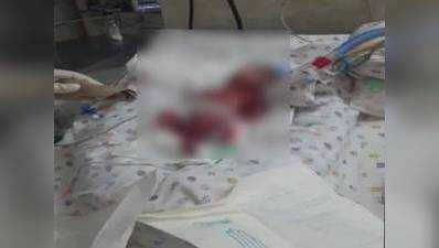 जिंदा नवजात को मृत घोषित करने के मामले में दिल्ली के अस्पताल के खिलाफ केस दर्ज