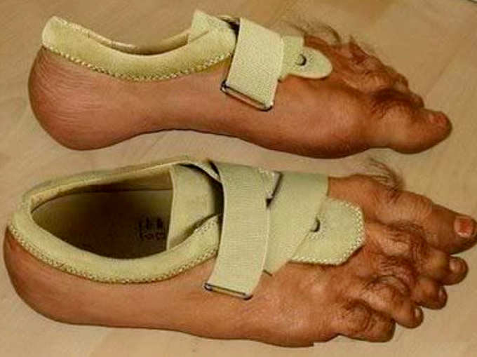 जूते हैं या पैर?
