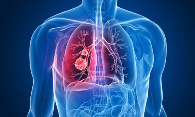 நுரையீரல் சம்பந்தப்பட்ட நோய்கள் (Lung diseases):