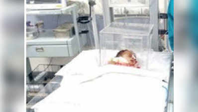 244 दिन की बच्ची का लैप्रोस्कोपी से निकाला पित्ताशय, वर्ल्ड रेकॉर्ड में दर्ज हुई सर्जरी