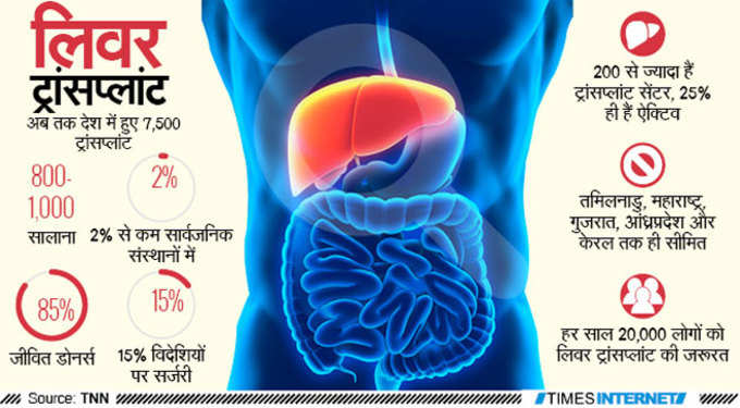 लिवर ट्रांसप्लांट