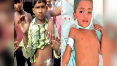 सीतापुर से बाराबंकी तक कुत्‍तों की दहशत में ग्रामीण, एक बच्‍चे पर फ‍िर हमला