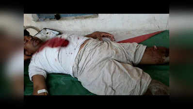 बलिया में बीजेपी कार्यकर्ता पर जानलेवा हमला, दोस्त को लगी गोली