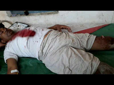 बलिया में बीजेपी कार्यकर्ता पर जानलेवा हमला, दोस्त को लगी गोली