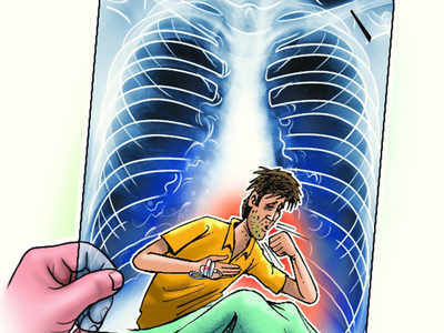 क्षयरुग्णांना हवा मोकळा श्वास