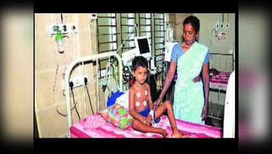तमिलनाडु: मासूम को जहरीले सांप ने काटा, डॉक्टरों ने 6 घंटे की मशक्कत के बाद जिंदा बचाया