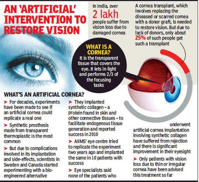 क्या है आर्टिफिशल कॉर्निया?
