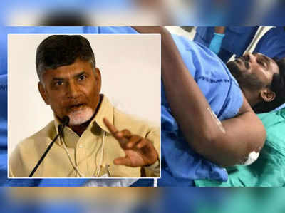 దాడి వెనుక ఎన్నో సందేహాలు.. కేంద్రం కుట్ర: చంద్రబాబు నాయుడు