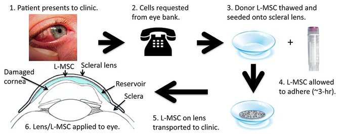 eye-contacts-band