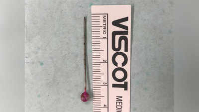 मुंबईः तरुणीच्या छातीतून काढली ३.५ सेंटीमीटरची पिन