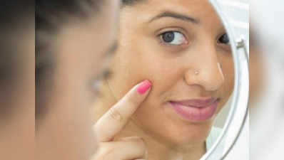 How to remove black spots on face in Hindi: चेहरे से ऐसे हटाएं डार्क स्पॉट्स