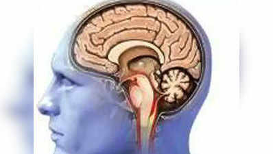 सिर दर्द से परेशान था, जांच में डॉक्टरों ने पाया कान के रास्ते बाहर आ रहा मस्तिष्क का हिस्सा