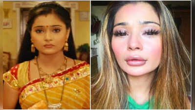 Sara Khan: बिदाईच्या अभिनेत्रीला लीप सर्जरी महागात?