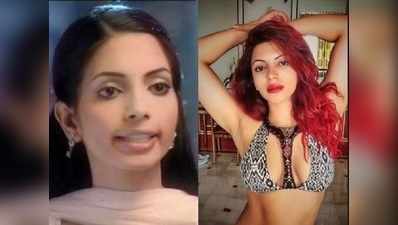 Surgery के बाद Shama Sikander के लुक में SHOCKING Transformation