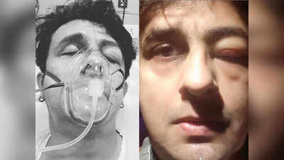 Sonu Nigam ने तस्वीर शेयर कर बताई ICU पहुंचने की वजह