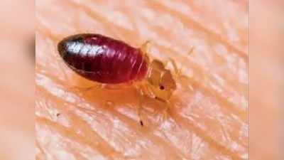 Bed Bugs Bites: ತಿಗಣೆ ಕಾಟದಿಂದ ಮುಕ್ತಿ ಪಡೆಯಲು ಇಲ್ಲಿದೆ ಮನೆ ಮದ್ದು