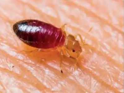 Bed Bugs Bites: ತಿಗಣೆ ಕಾಟದಿಂದ ಮುಕ್ತಿ ಪಡೆಯಲು ಇಲ್ಲಿದೆ ಮನೆ ಮದ್ದು