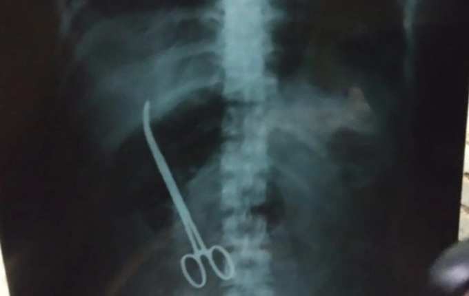 x-ray রিপোর্ট