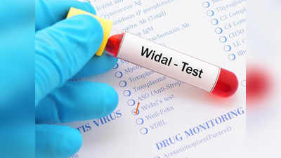 Widal Test: विडाल टेस्ट पॉजिटिव आने का मतलब हमेशा टायफायड नहीं होता