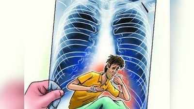 world TB day: ಕ್ಷಯ ರೋಗದ ಬಗ್ಗೆ ಎಚ್ಚರ ಅಗತ್ಯ!