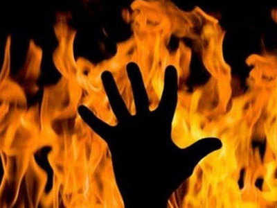 प्रमुख पार्टी के नेता पर पत्नी को जलाने का आरोप, केस दर्ज