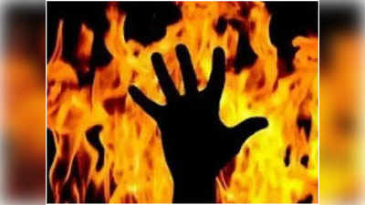 लखनऊः प्रेमी ने खुद पर पेट्रोल डाला तो गुस्से में प्रेमिका ने लगा दी आग