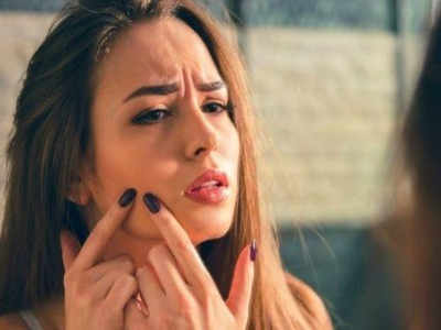 Pimples से हैं परेशान तो टूथपेस्ट के साथ लगाएं ये 3 चीजें