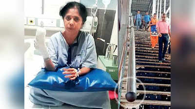 मलाड स्टेशन पर सीढ़ियों की रेलिंग में फंसकर कटी महिला की उंगली, रेलवे ने दिया मुआवजा, जांच के आदेश