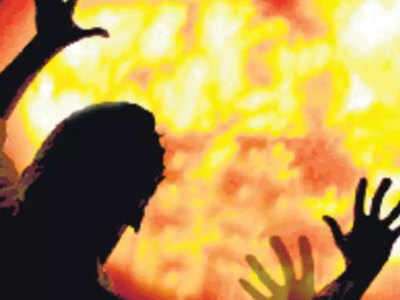 बरेलीः महिला होमगार्ड को जिंदा जलाने की कोशिश, रिश्तेदार पर आरोप