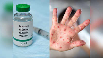 WHO ने कहा, अब Measles फ्री है श्री लंका, भारत का टारगेट अगले साल तक