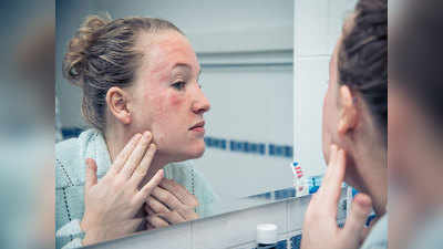 Dermatitis: त्वचा पर होने वाली यह बीमारी कर देती है परेशान, जानें कैसे बचें