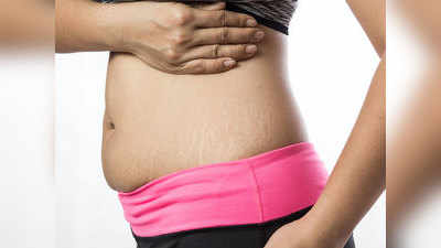 आखिर क्यों होते हैं प्रेग्नेंसी Stretch Marks, जानें उनसे बचने के टिप्स