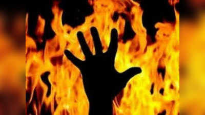 देवरिया: छेड़छाड़ से परेशान छात्रा ने लगाई आग, हालत गंभीर