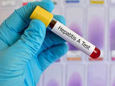 Hepatitis A के कारण, लक्षण और बचाव के तरीके