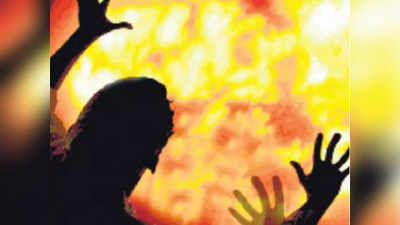 कुशीनगर: छेड़खानी का विरोध करने पर युवती को जिंदा जलाया, हालत गंभीर