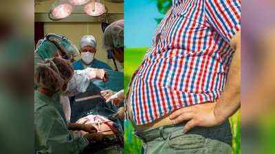 15 सालों में 100 गुना बढ़ी Weight Loss के लिए की जाने वाली सर्जरी
