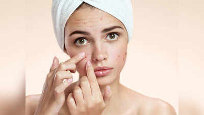 मॉनसून में बढ़ जाती है Acne की समस्या, ऐसे करें Skin care
