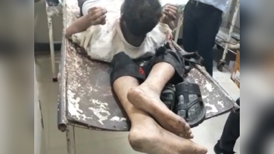 फरीदाबाद: मरीज के कटे हुए पैर सिर के पास रखे, विडियो वायरल