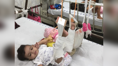11 महीने की बच्ची की टांग फ्रैक्चर, गुड़िया को चढ़ा प्लास्टर तब करवाया अपना इलाज