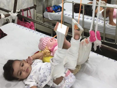 11 महीने की बच्ची की टांग फ्रैक्चर, गुड़िया को चढ़ा प्लास्टर तब करवाया अपना इलाज