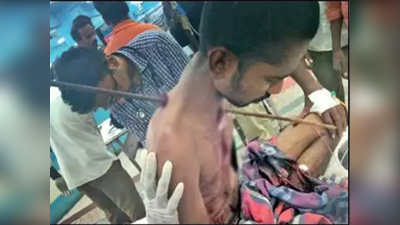 तमिलनाडु: युवक के शरीर में घुसी 4 फुट की सरिया