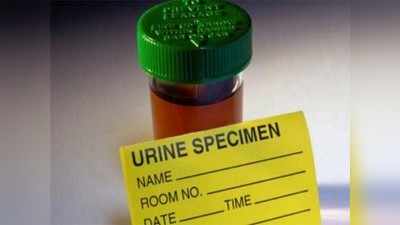 ಮೂತ್ರದ ಈ 9 ಬಣ್ಣದಿಂದ ನಿಮ್ಮ ಆರೋಗ್ಯದ ಸ್ಥಿತಿ ತಿಳಿಯಬಹುದು