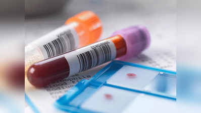 क्या आपको पता है? क्यों कराते रहना चाहिए Blood Test