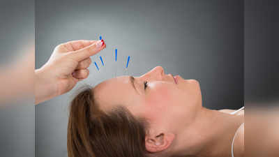 Acupuncture: दर्द को इस तरह कर दें पंक्चर